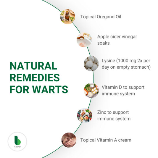 Warts