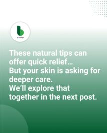 Psoriasis (Rapid Relief)